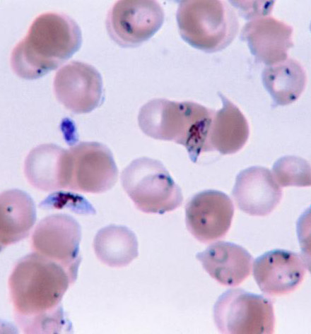 plasmodium blood