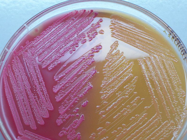 MacConkey's agar