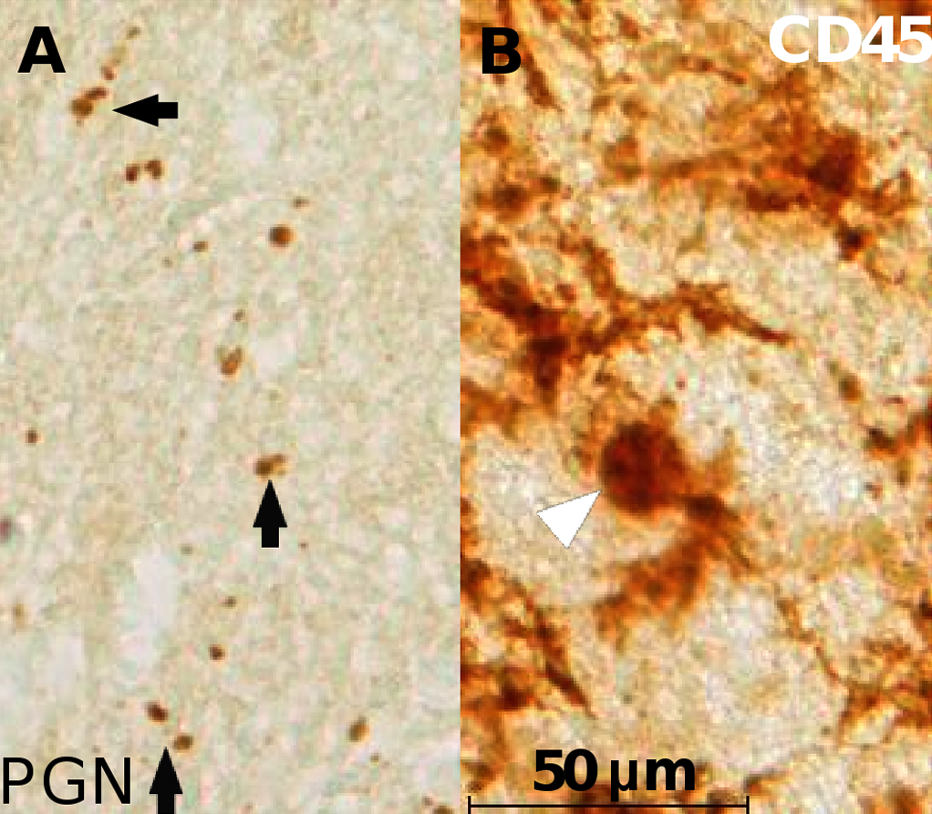 bacteria in brain