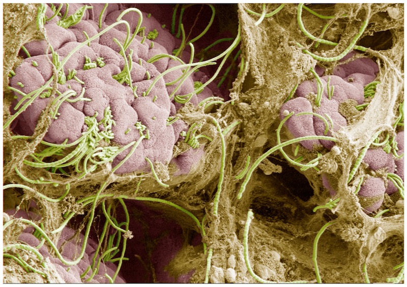 segmented filamentous bacteria