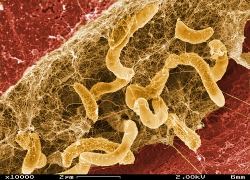 thumb_biofilm_of_desulfovibrio_desulfuricans