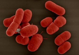 Acinetobacter baumannii