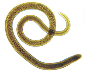 trichinella spiralis