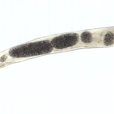 TWiP 19: Enterobius vermicularis, the pinworm