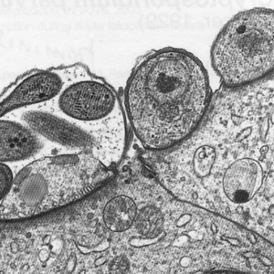 TWiP 18: Cryptosporidium