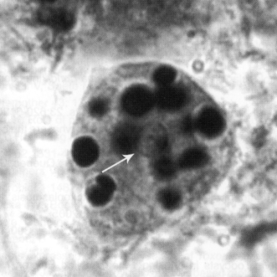 TWiP 17: Entamoeba histolytica