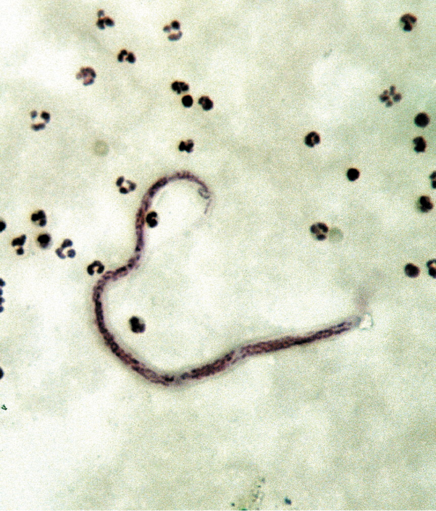 loa microfilariae