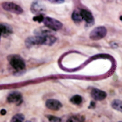 TWiP 24: Onchocerca volvulus, a vector-borne, filarial nematode