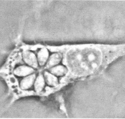 TWiP 12: Toxoplasma gondii