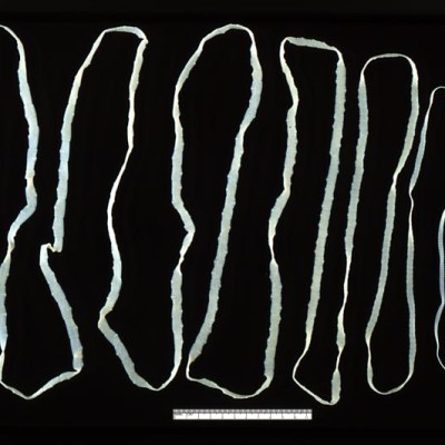 TWiP 6: Tapeworms, the long and short of it