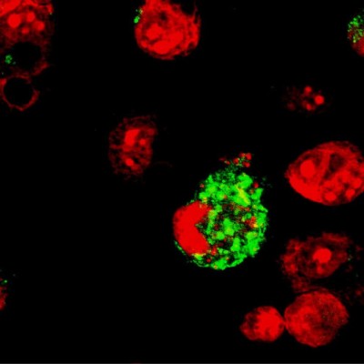 TWiP 32: Evasive trypanosomes and schistosomes