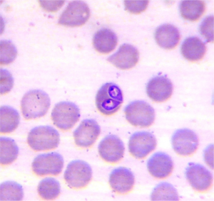 Babesia vogeli