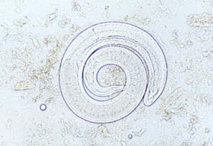 Trichinella pseudospiralis