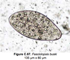 Fasciolopsis buski egg