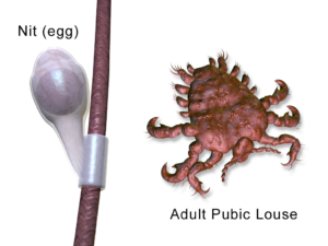 Pubic louse