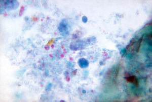 Dientamoeba fragilis