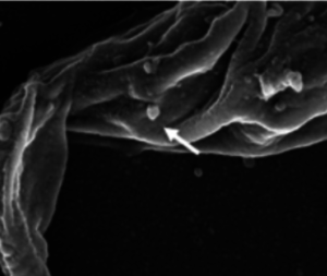 Leishmania extracellular vesicles