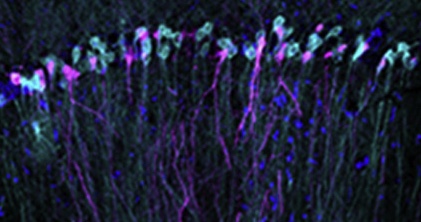 neural circuit tracing