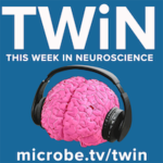 TWiN 30: Gut to brain spread of alpha-synuclein in Parkinson’s disease